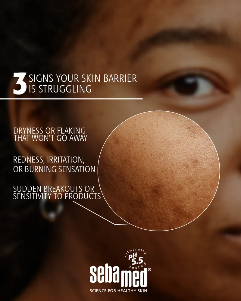 Post: three signs your skin barrier is struggling